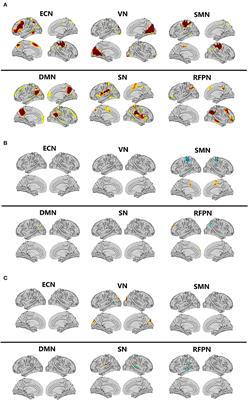 Altered Effective Connectivity of Resting-State Networks by Tai Chi Chuan in Chronic Fatigue Syndrome Patients: A Multivariate Granger Causality Study